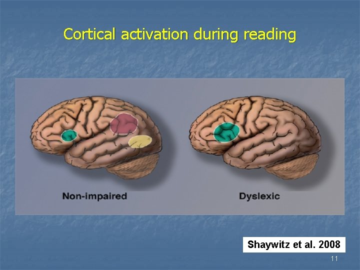 Cortical activation during reading Shaywitz et al. 2008 11 