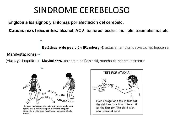 SINDROME CEREBELOSO Engloba a los signos y sintomas por afectación del cerebelo. Causas más