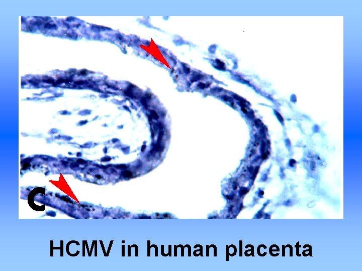HCMV in human placenta 