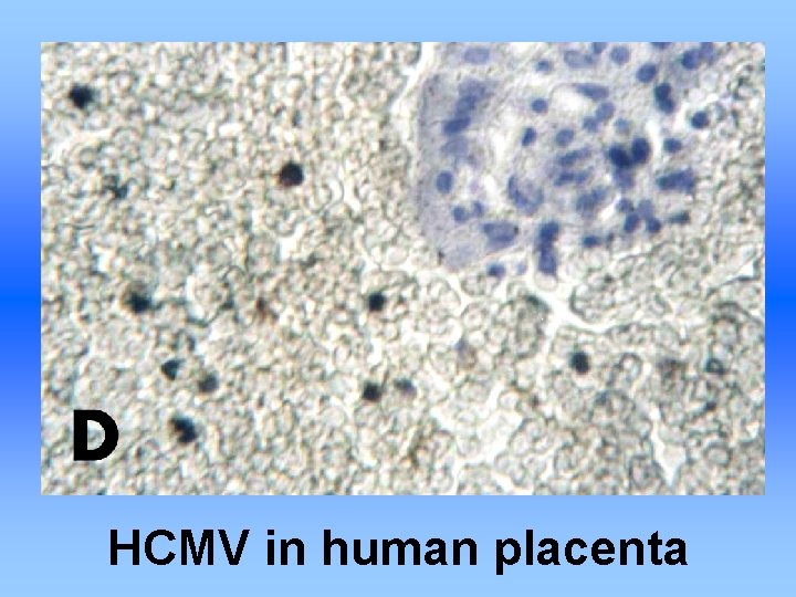 HCMV in human placenta 