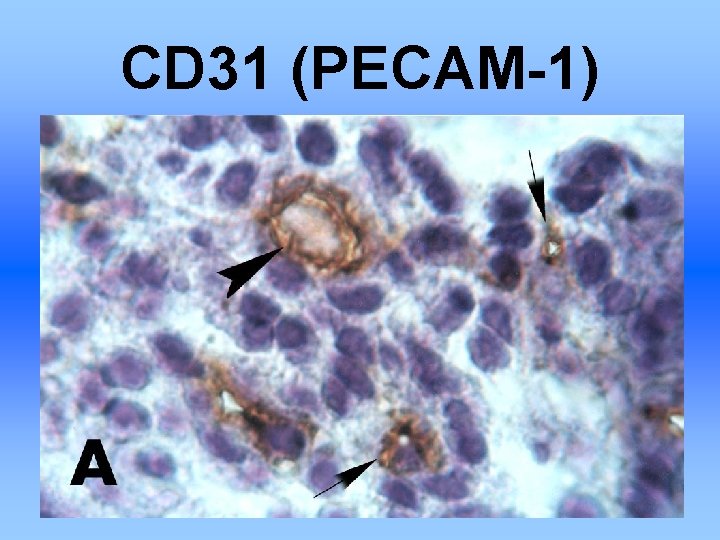 CD 31 (PECAM-1) 