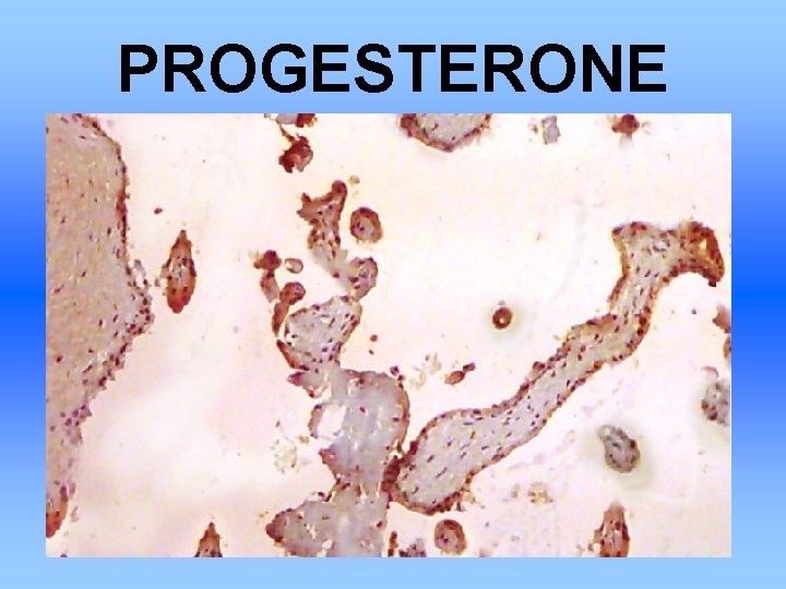 PROGESTERONE 