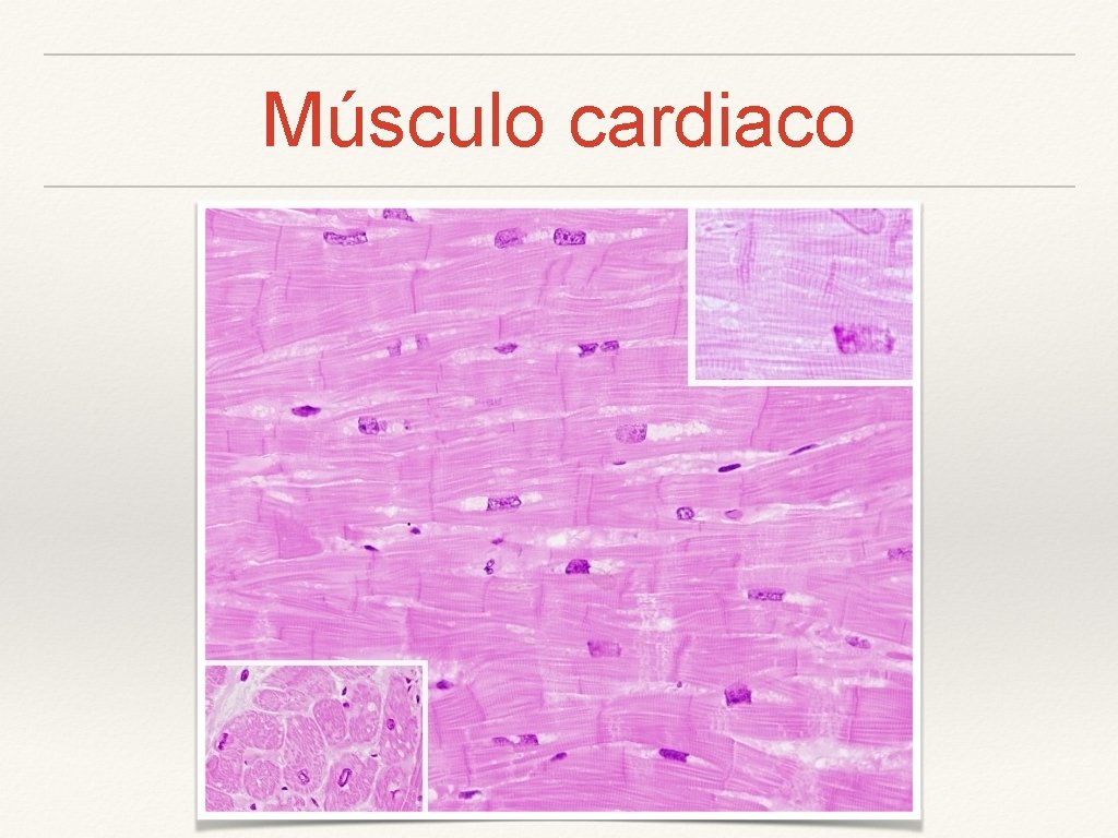 Músculo cardiaco 