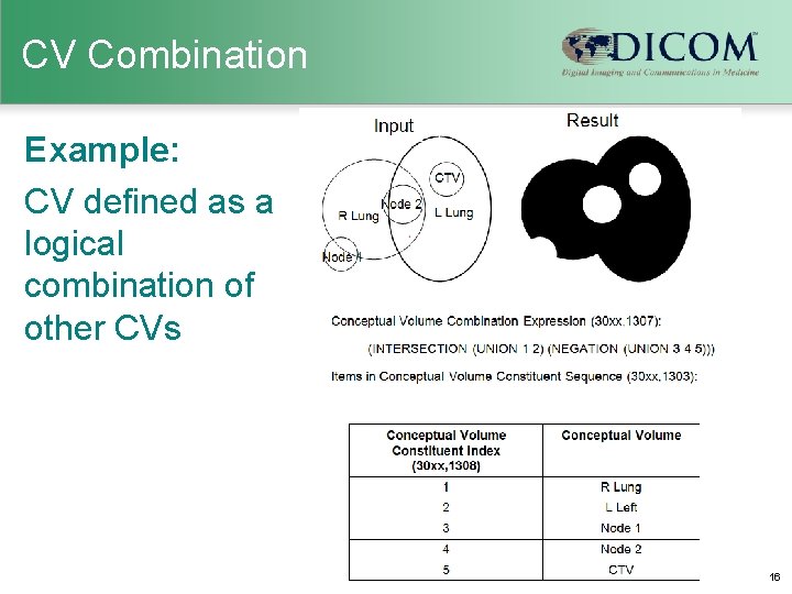 CV Combination Example: CV defined as a logical combination of other CVs DICOM Second