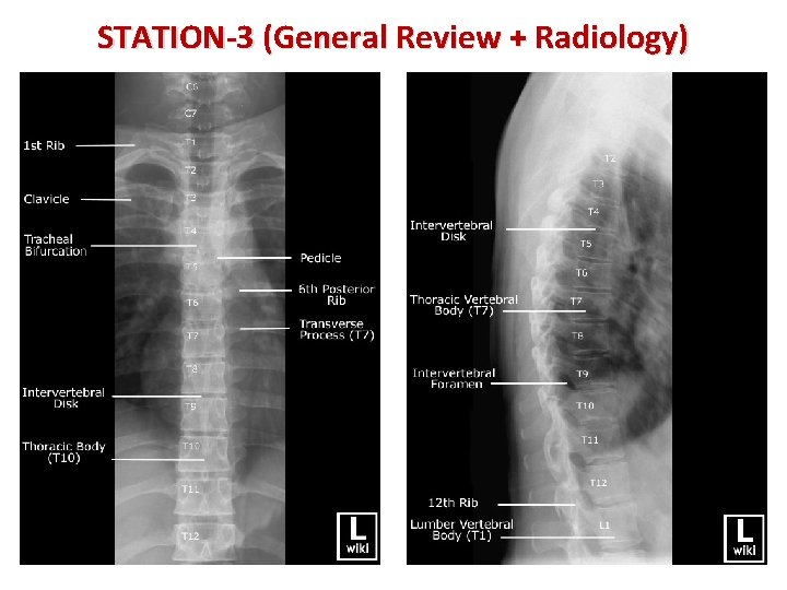 STATION-3 (General Review + Radiology) 