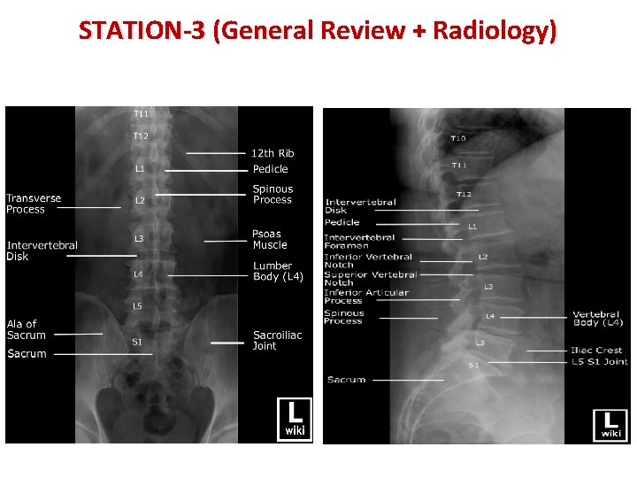 STATION-3 (General Review + Radiology) 