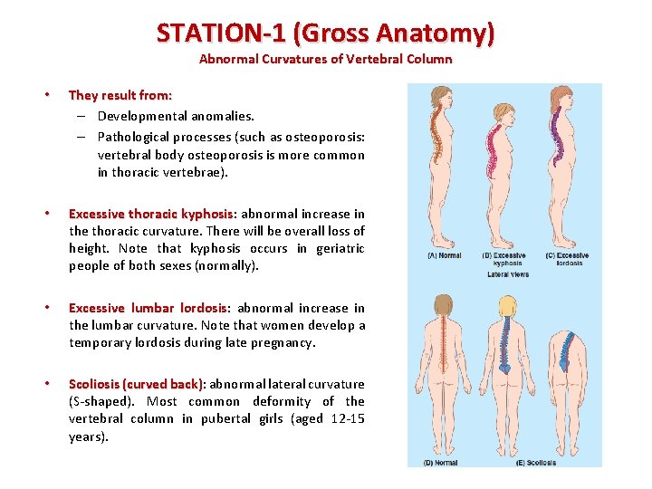 STATION-1 (Gross Anatomy) Abnormal Curvatures of Vertebral Column • They result from: – Developmental