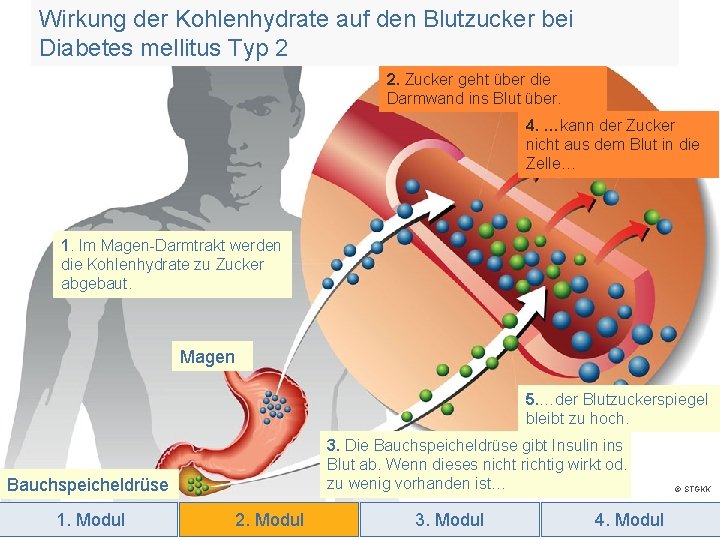 Wirkung der Kohlenhydrate auf den Blutzucker bei Diabetes mellitus Typ 2 2. Zucker geht