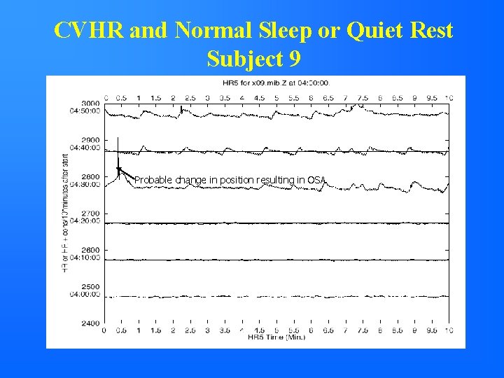 CVHR and Normal Sleep or Quiet Rest Subject 9 Probable change in position resulting