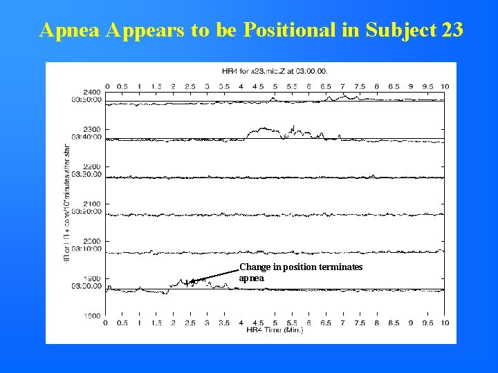 Apnea Appears to be Positional in Subject 23 Change in position terminates apnea 