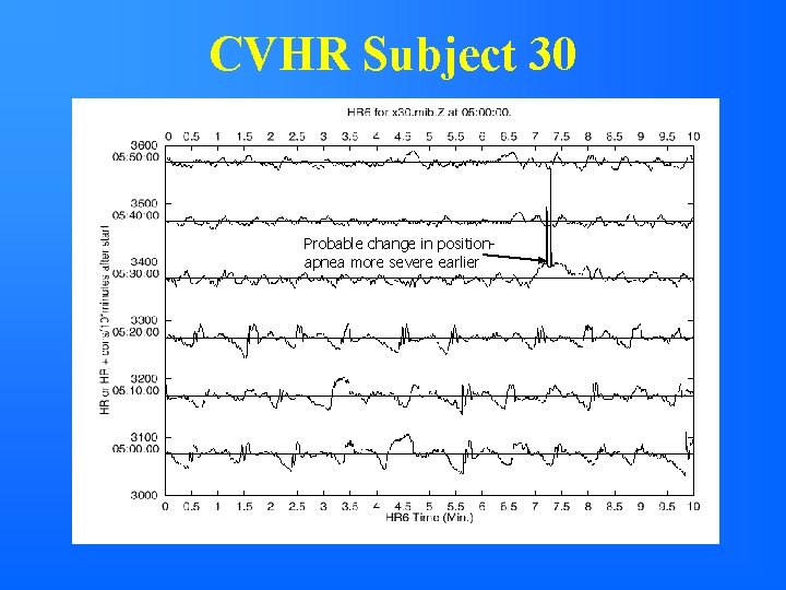 CVHR Subject 30 Probable change in positionapnea more severe earlier 