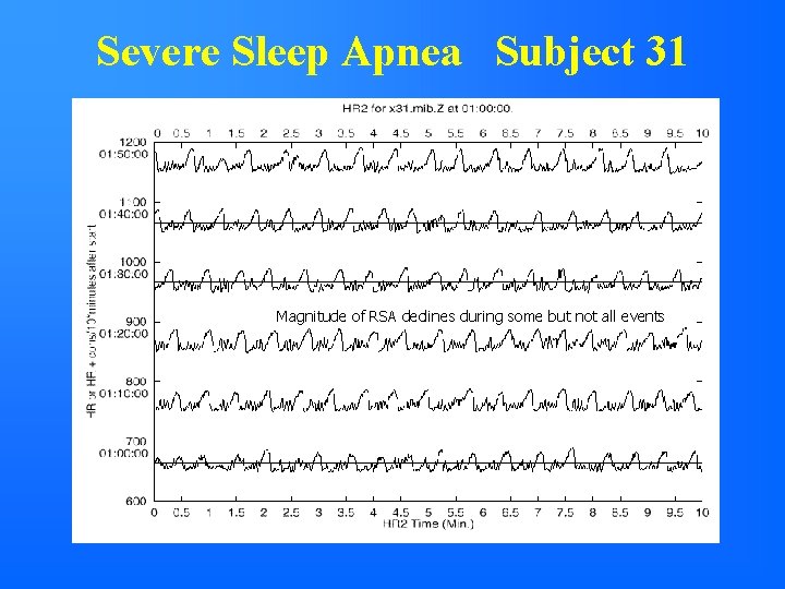 Severe Sleep Apnea Subject 31 Magnitude of RSA declines during some but not all