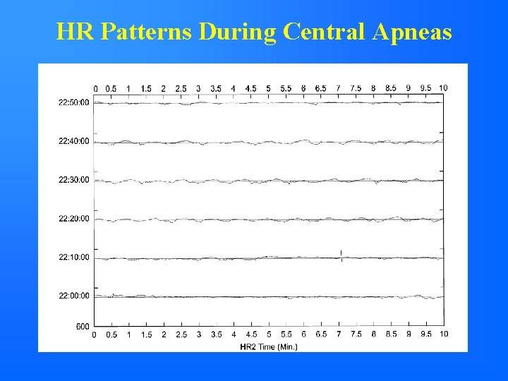 HR Patterns During Central Apneas 