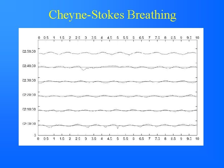 Cheyne-Stokes Breathing 