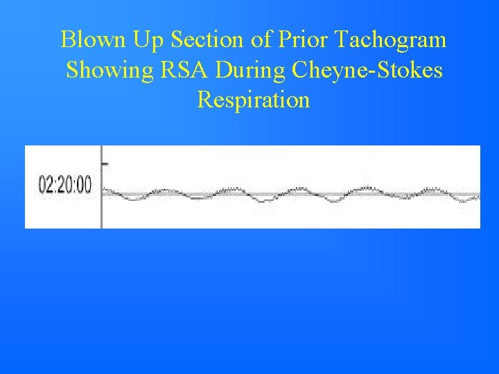 Blown Up Section of Prior Tachogram Showing RSA During Cheyne-Stokes Respiration 