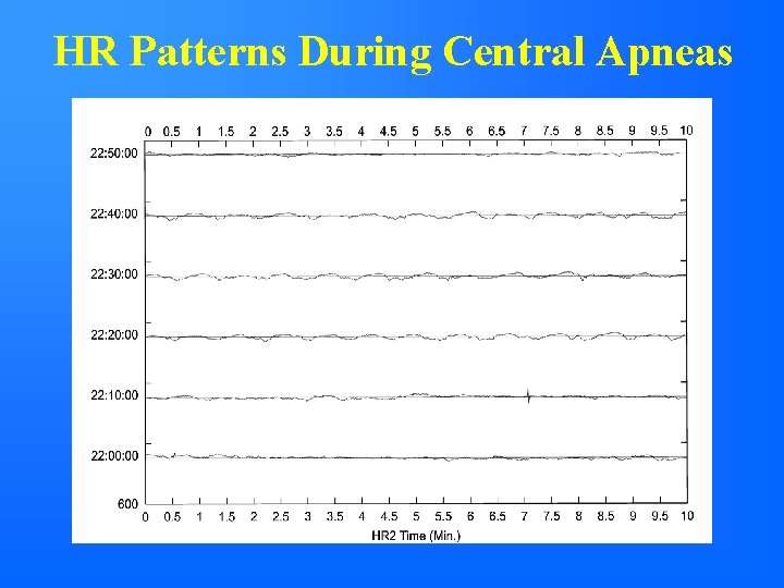 HR Patterns During Central Apneas 