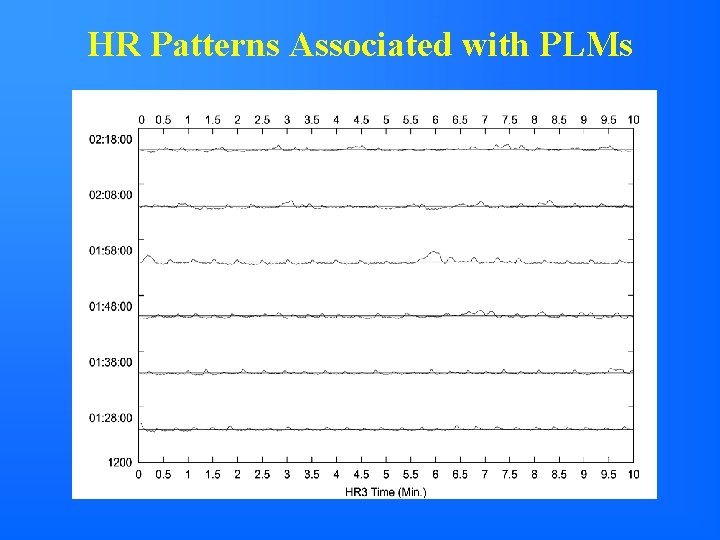 HR Patterns Associated with PLMs 