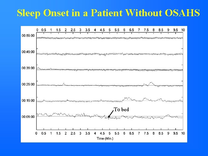 Sleep Onset in a Patient Without OSAHS To bed 