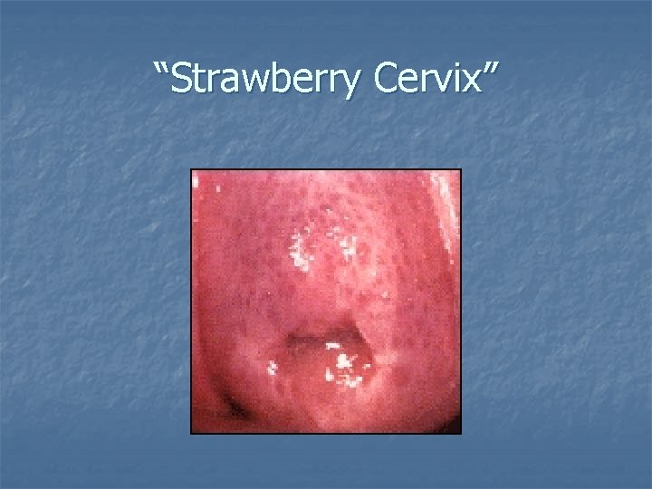 “Strawberry Cervix” 