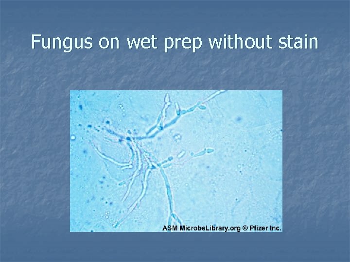 Fungus on wet prep without stain 