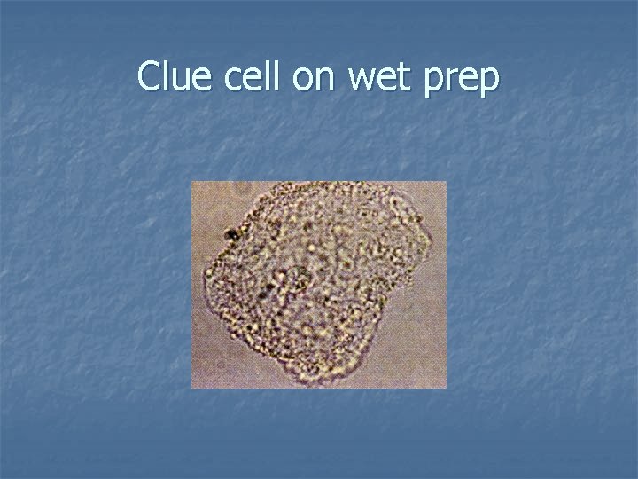 Clue cell on wet prep 