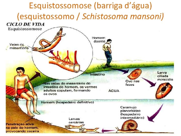 Esquistossomose (barriga d’água) (esquistossomo / Schistosoma mansoni) 