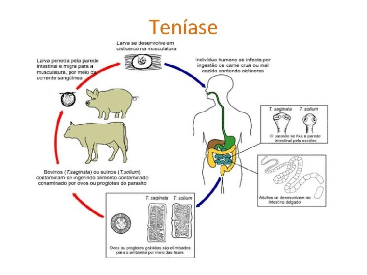 Teníase 