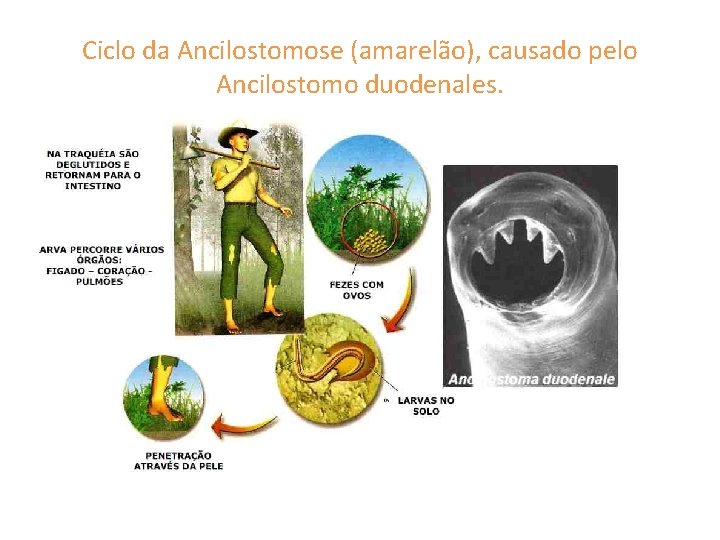 Ciclo da Ancilostomose (amarelão), causado pelo Ancilostomo duodenales. 