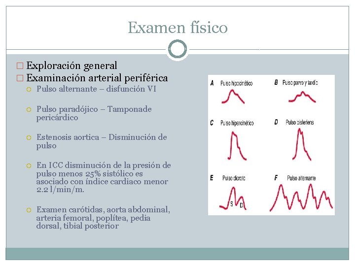 Examen físico � Exploración general � Examinación arterial periférica Pulso alternante – disfunción VI