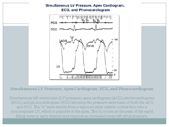 Simultaneous LV Pressure, Apex Cardiogram, ECG, and Phonocardiogram Simultaneous left ventricular (LV) pressure, apex