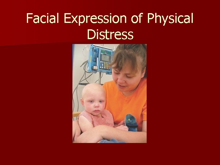 Facial Expression of Physical Distress 
