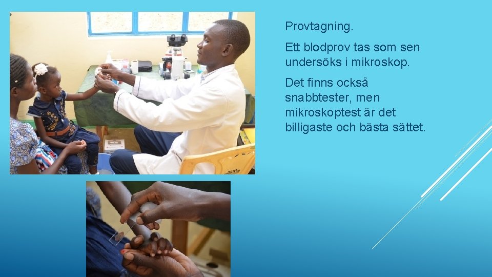 Provtagning. Ett blodprov tas som sen undersöks i mikroskop. Det finns också snabbtester, men