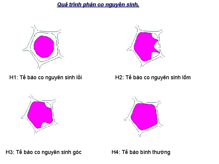 Quá trình phản co nguyên sinh. H 1: Tế bào co nguyên sinh lồi