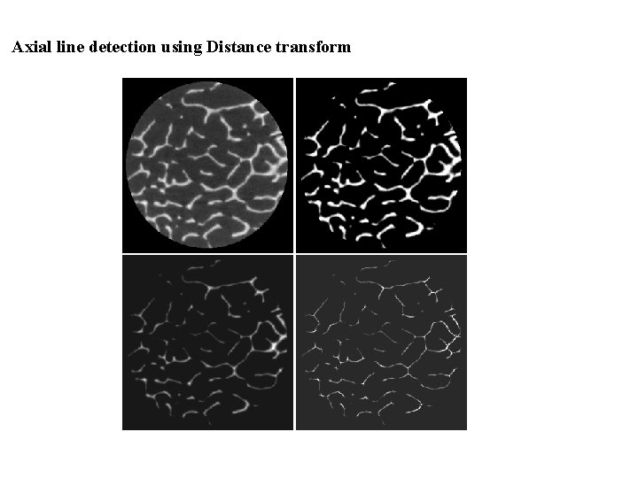 Axial line detection using Distance transform 
