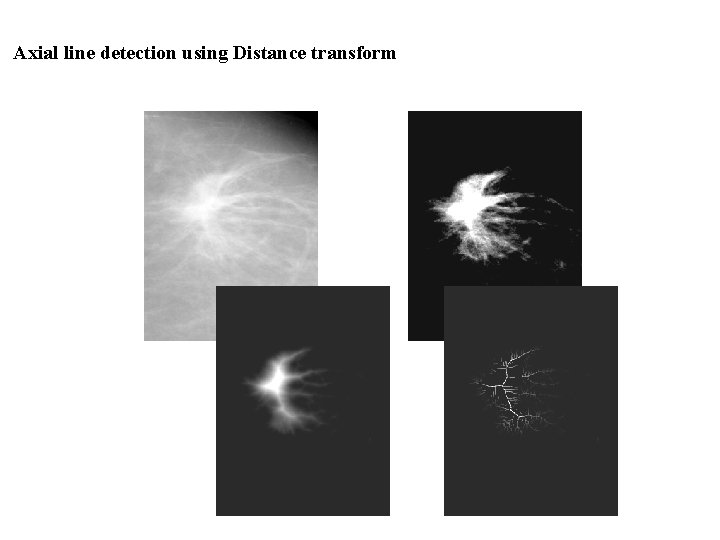 Axial line detection using Distance transform 