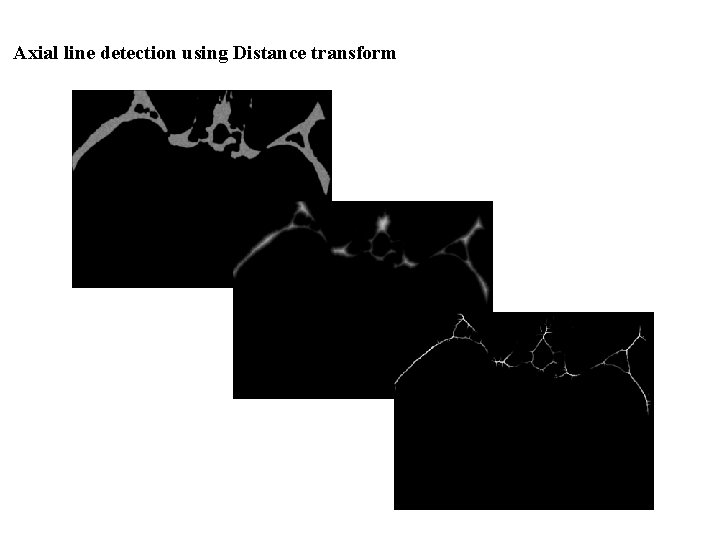 Axial line detection using Distance transform 