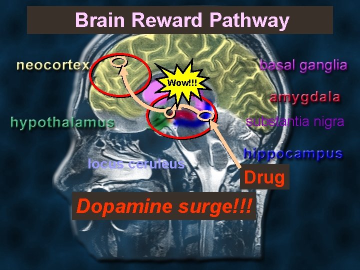  Brain Reward Pathway Wow!!! substantia nigra locus ceruleus Drug Dopamine surge!!! 