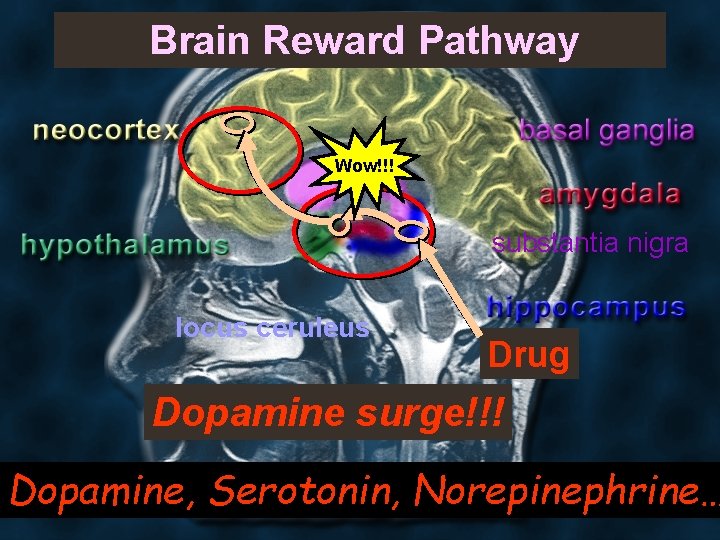  Brain Reward Pathway Wow!!! substantia nigra locus ceruleus Drug Dopamine surge!!! Dopamine, Serotonin,