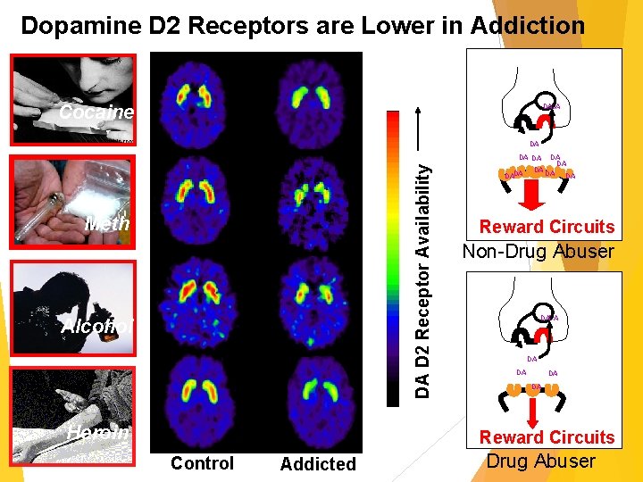 Dopamine D 2 Receptors are Lower in Addiction Cocaine DADA DA D 2 Receptor