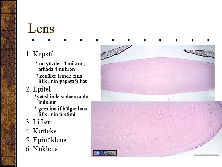 Lens 1. Kapsül * ön yüzde 14 mikron, arkada 4 mikron * zonüler lamel: