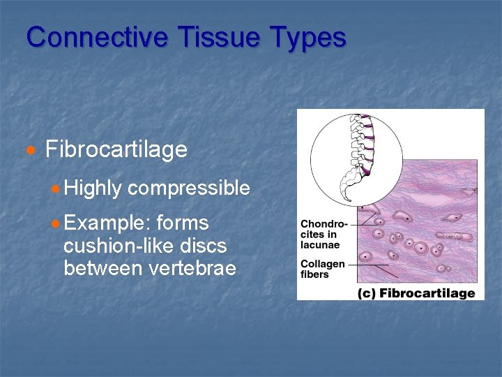 Connective Tissue Types · Fibrocartilage · Highly compressible · Example: forms cushion-like discs between