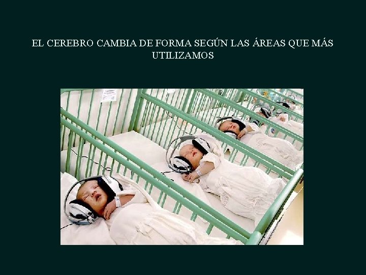 EL CEREBRO CAMBIA DE FORMA SEGÚN LAS ÁREAS QUE MÁS UTILIZAMOS 
