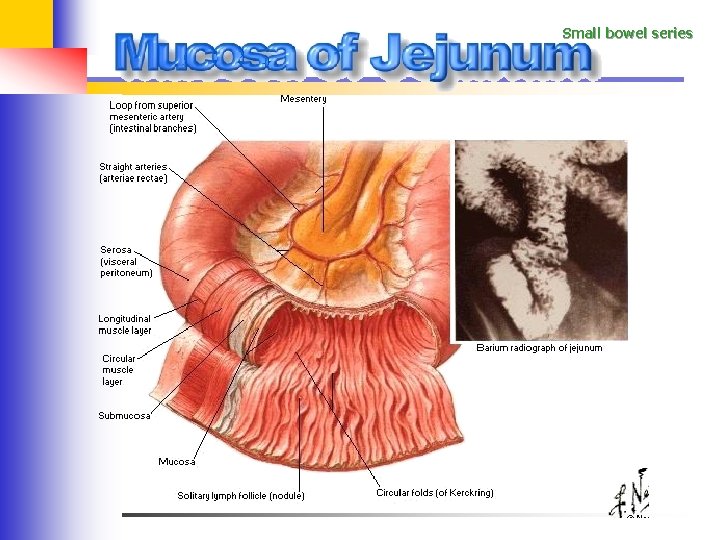 Small bowel series 