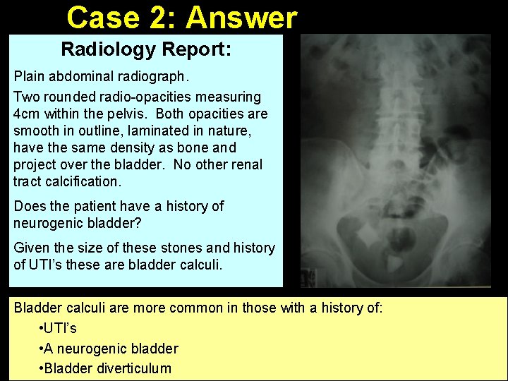 Case 2: Answer Radiology Report: Plain abdominal radiograph. Two rounded radio-opacities measuring 4 cm