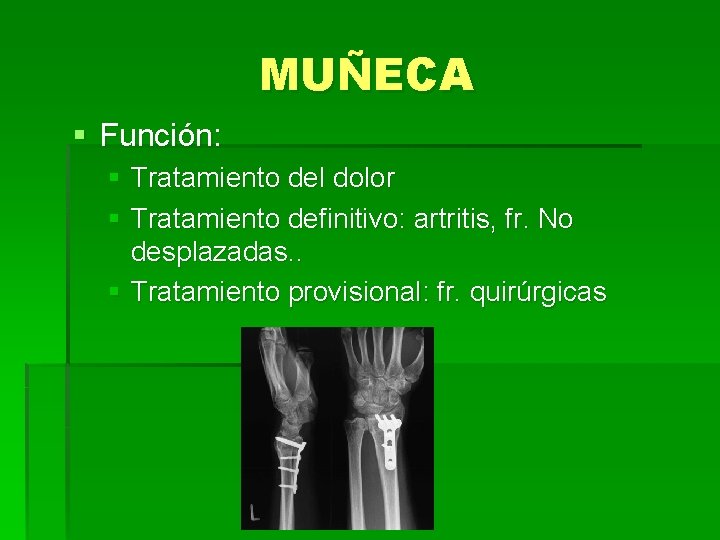MUÑECA § Función: § Tratamiento del dolor § Tratamiento definitivo: artritis, fr. No desplazadas.