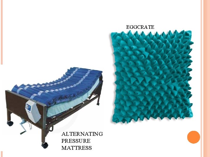 EGGCRATE ALTERNATING PRESSURE MATTRESS 