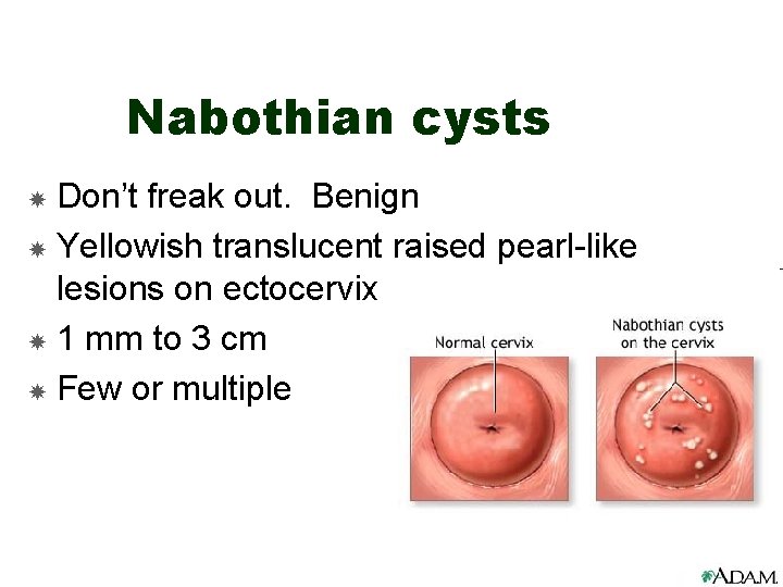 Nabothian cysts Don’t freak out. Benign Yellowish translucent raised pearl-like lesions on ectocervix 1