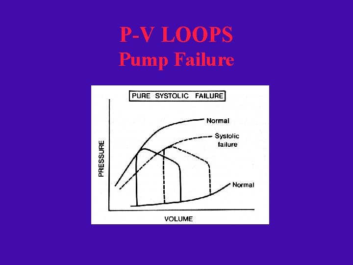 P-V LOOPS Pump Failure 