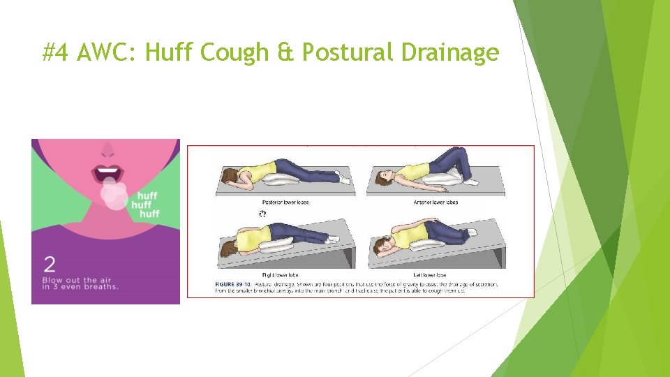 #4 AWC: Huff Cough & Postural Drainage 