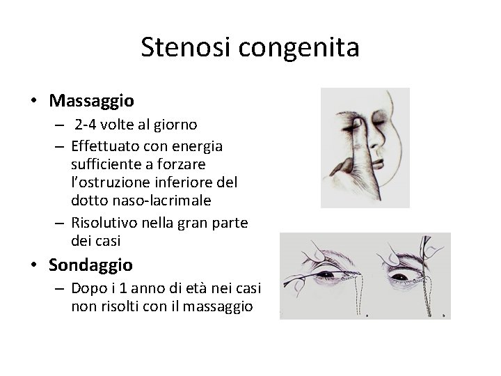 Stenosi congenita • Massaggio – 2 -4 volte al giorno – Effettuato con energia